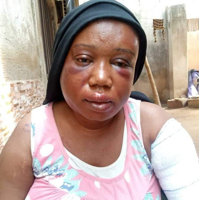 PHCN staff battered his Journalists wife