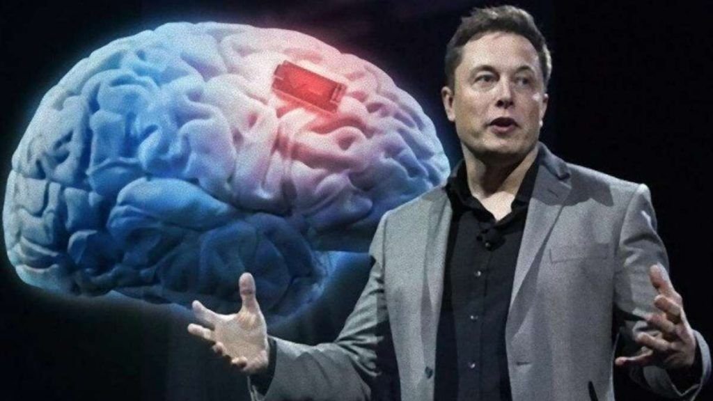 Elon Musk gets approval to put his brain chips on human